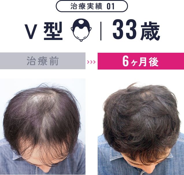 治療実績1