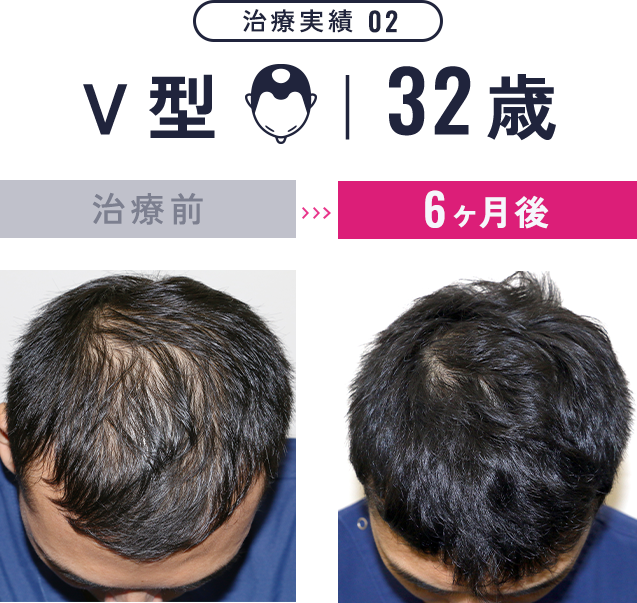 治療実績2