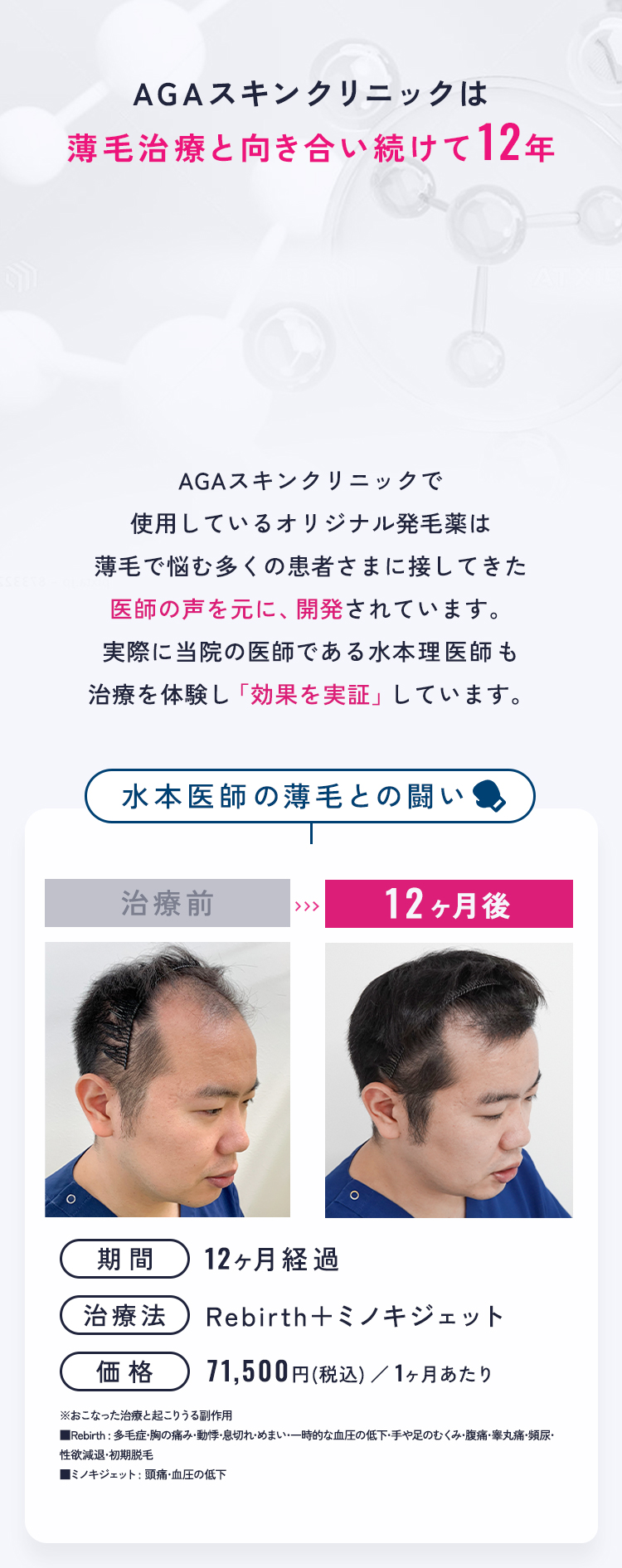 AGAスキンクリニックは薄毛治療と向き合い続けて12年