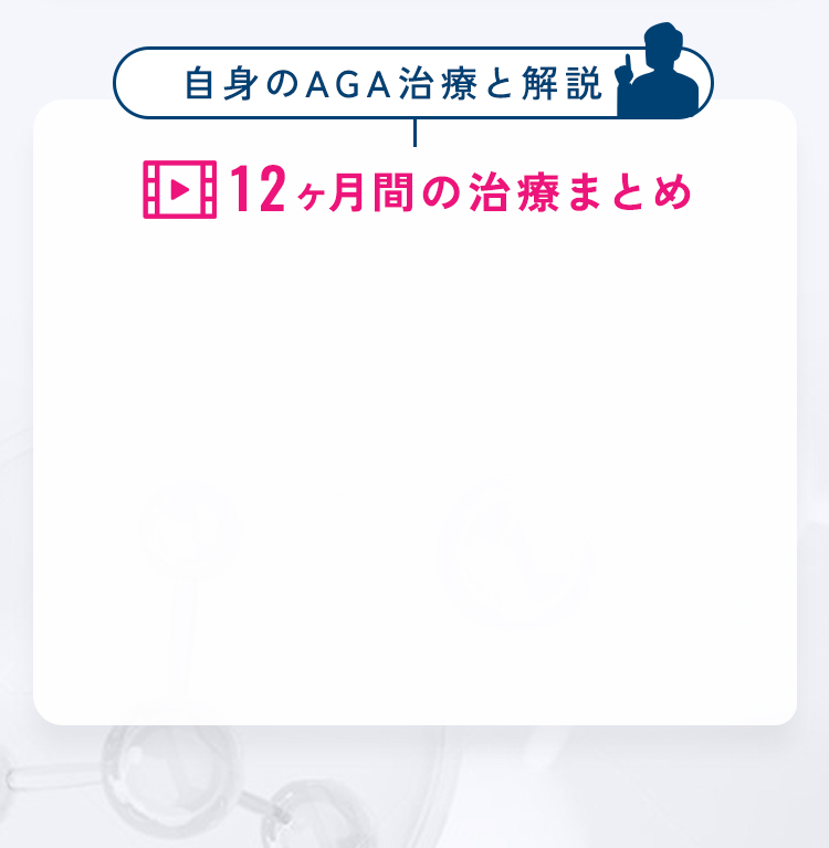 自身のAGA治療と解説／12ヶ月間の治療まとめ