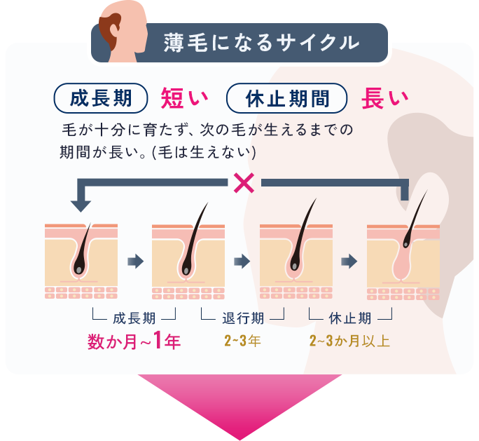 薄毛になるサイクル