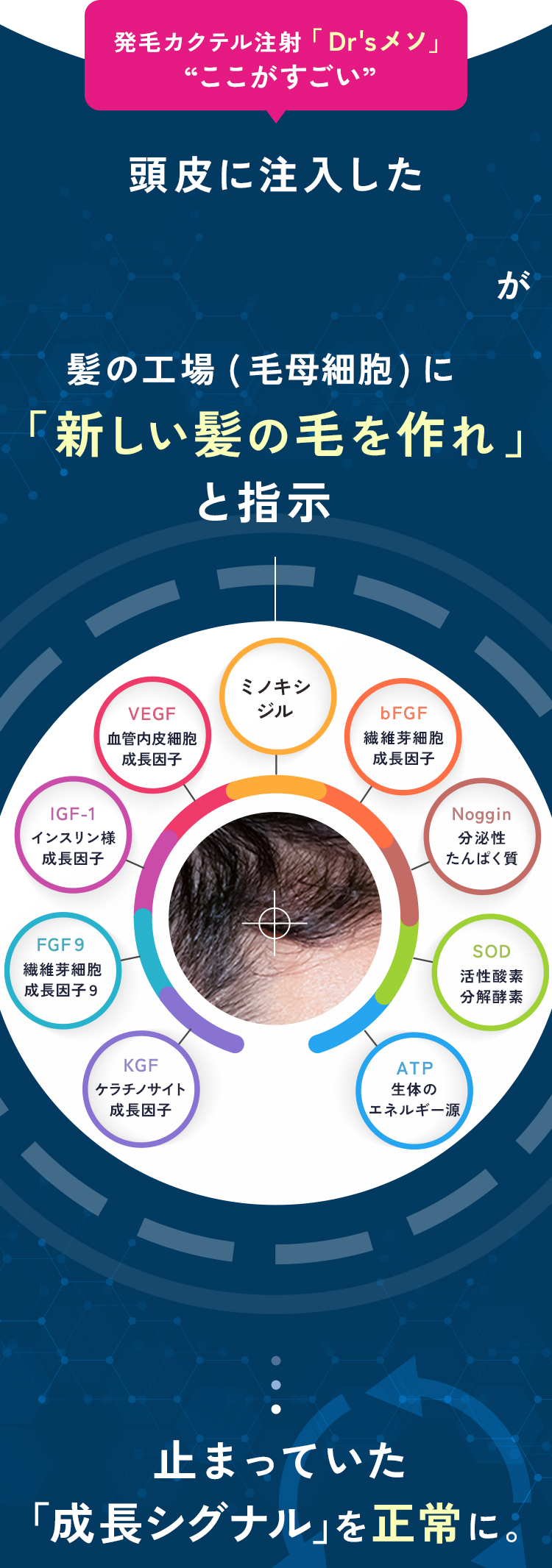 発毛カクテル注射「Dr'sメソ」“ここがすごい”頭皮に注入した発毛成長因子が、新しい髪の毛を作れと指示
