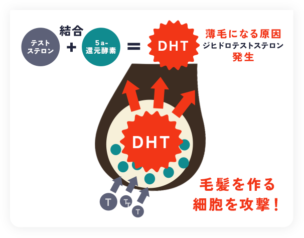 薄毛の原因図