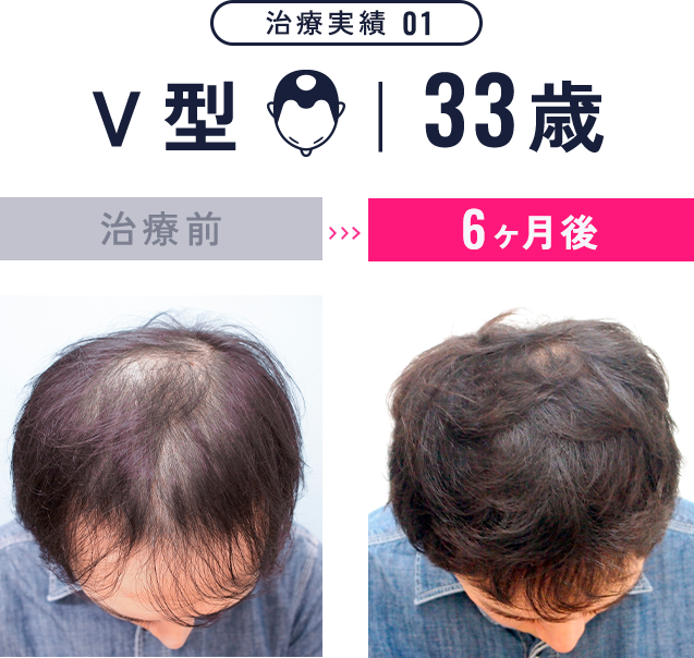 治療実績1