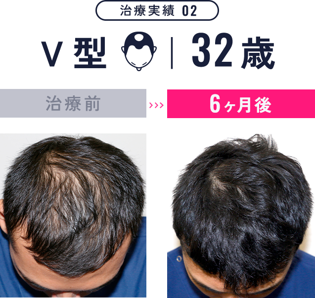 治療実績2