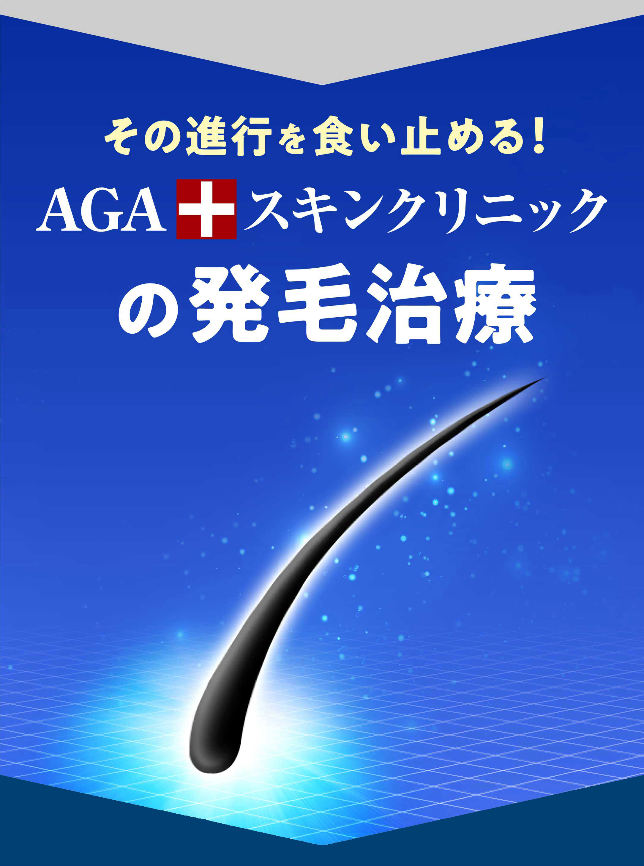 AGAスキンクリニックの発毛治療