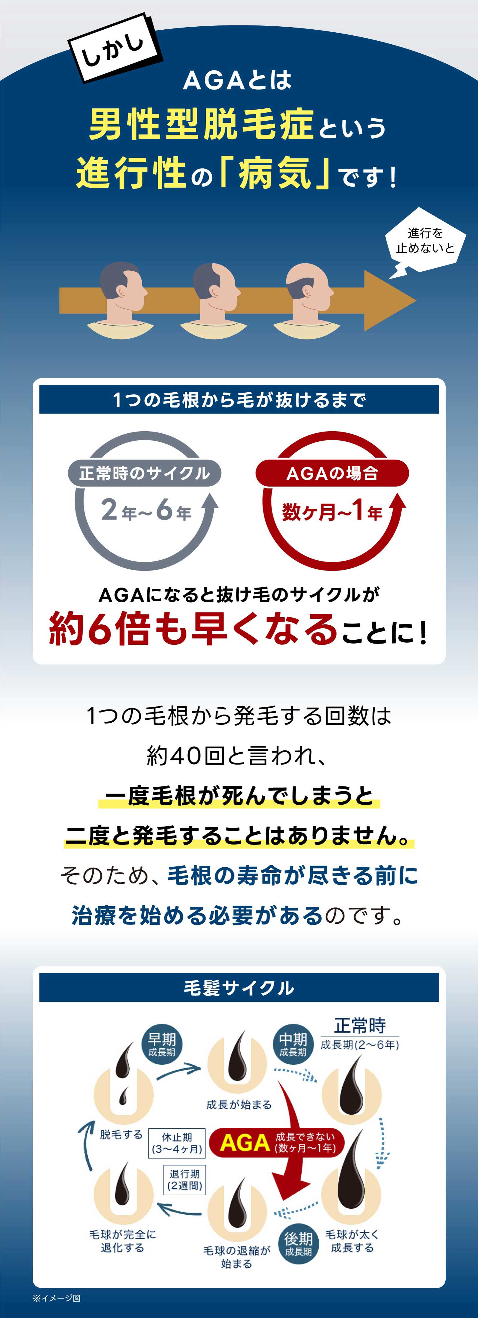 AGAとは男性型脱毛症という進行性の「病気」です