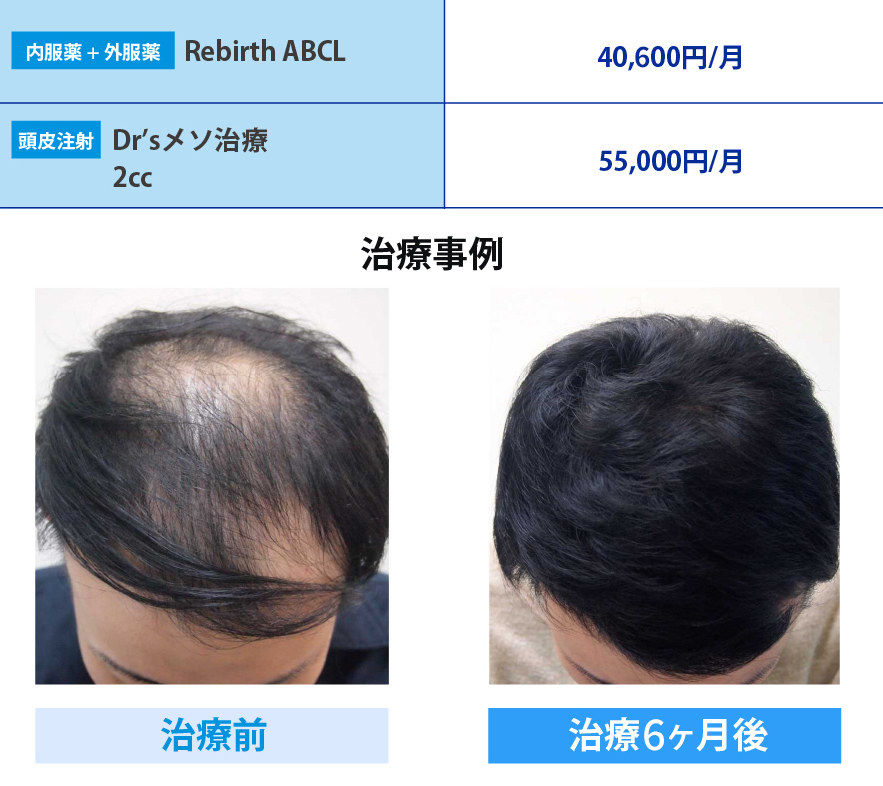医薬品
