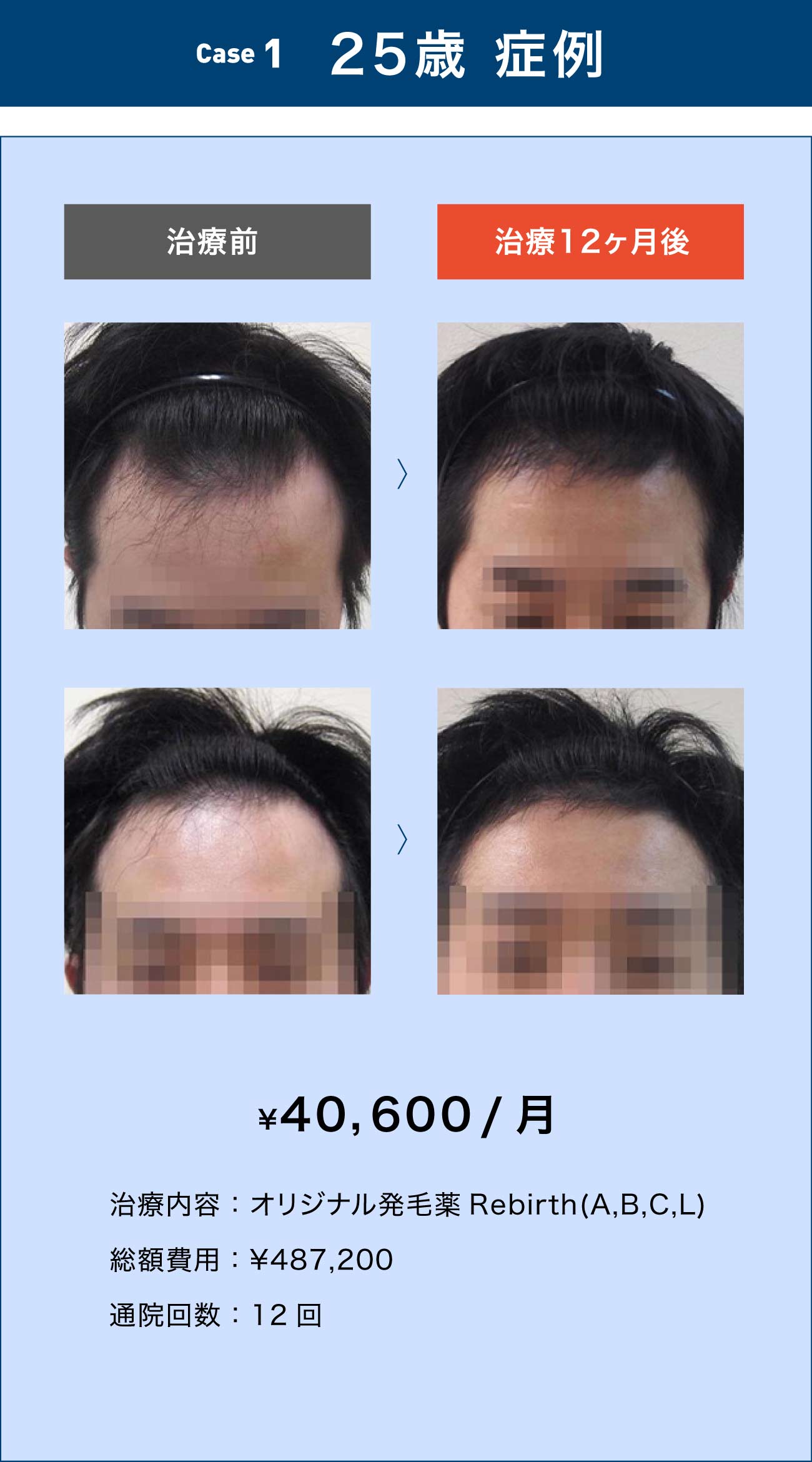25歳 症例