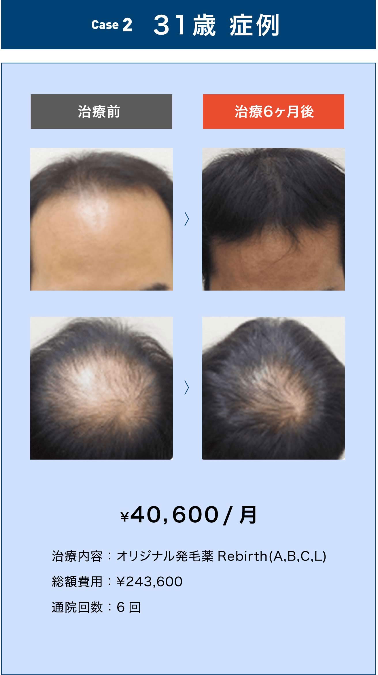 31歳 症例