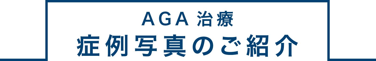 AGA治療症例写真のご紹介