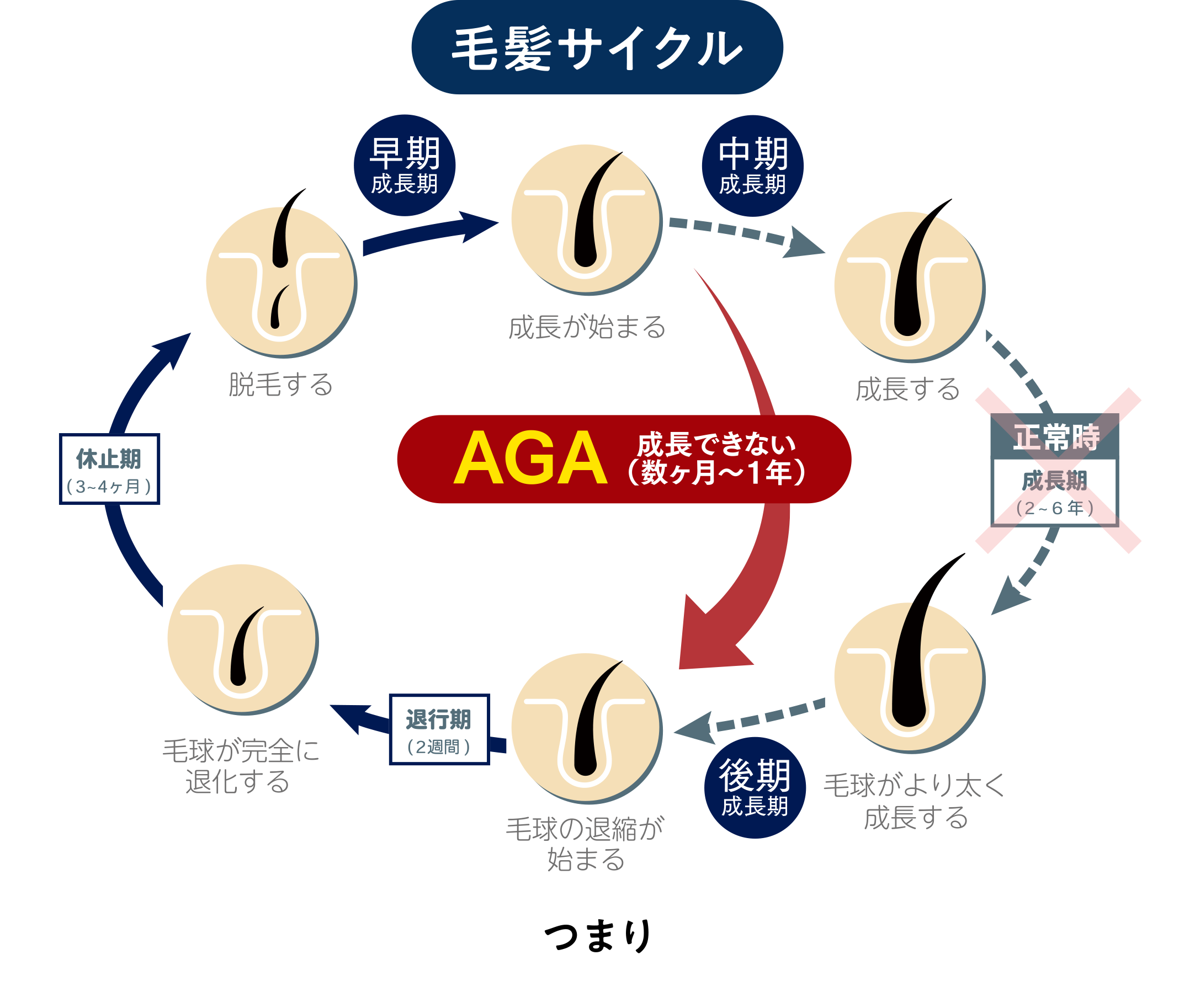 毛髪サイクル