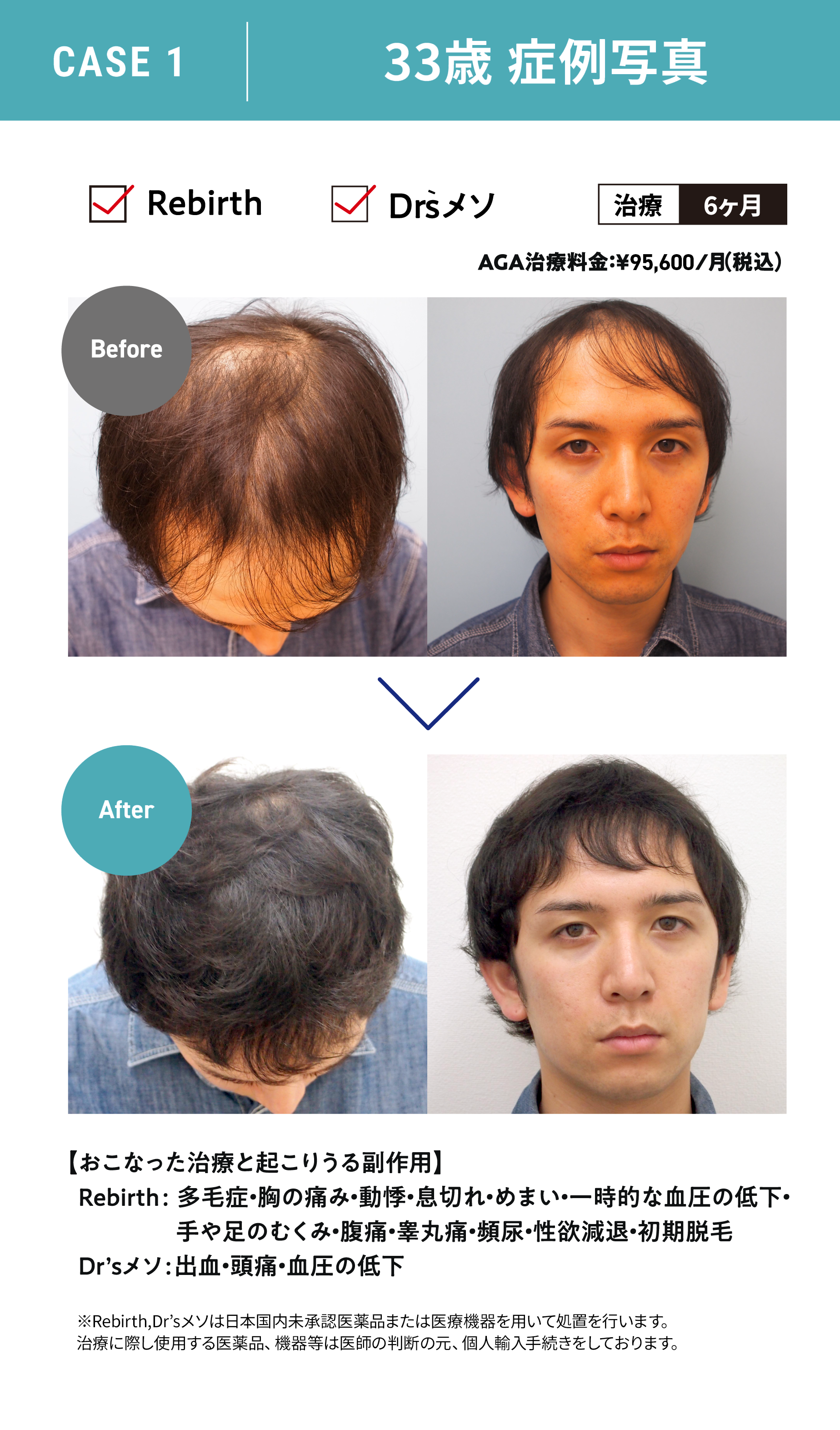 33歳 症例写真