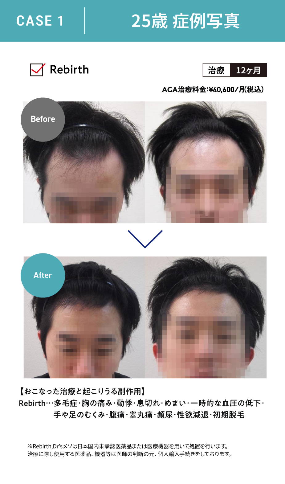 25歳 症例写真