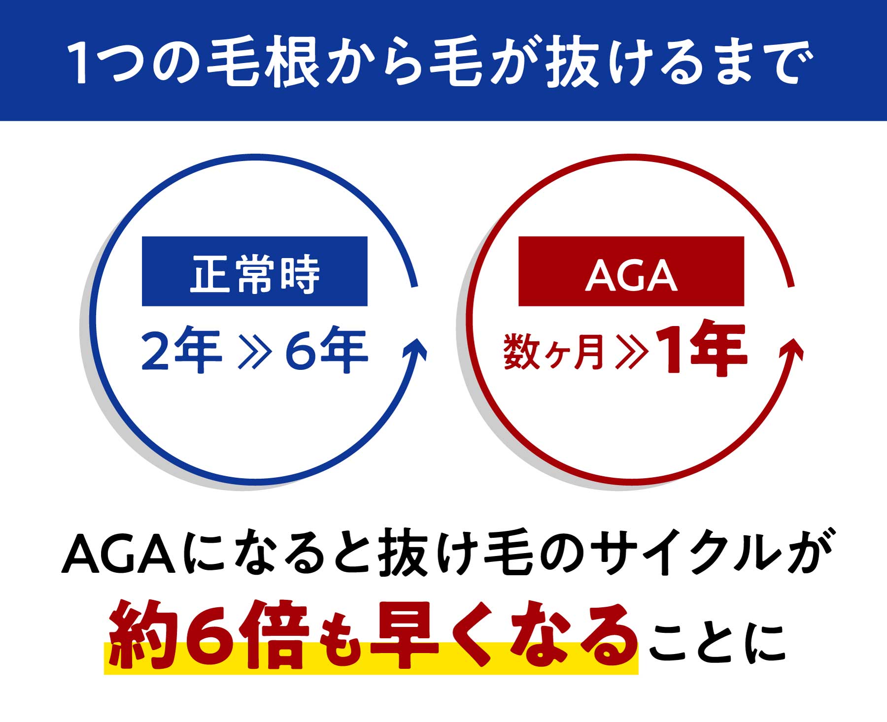 1つの毛根から毛が抜けるまでAGAになると抜け毛のサイクルが約6倍も早くなることに