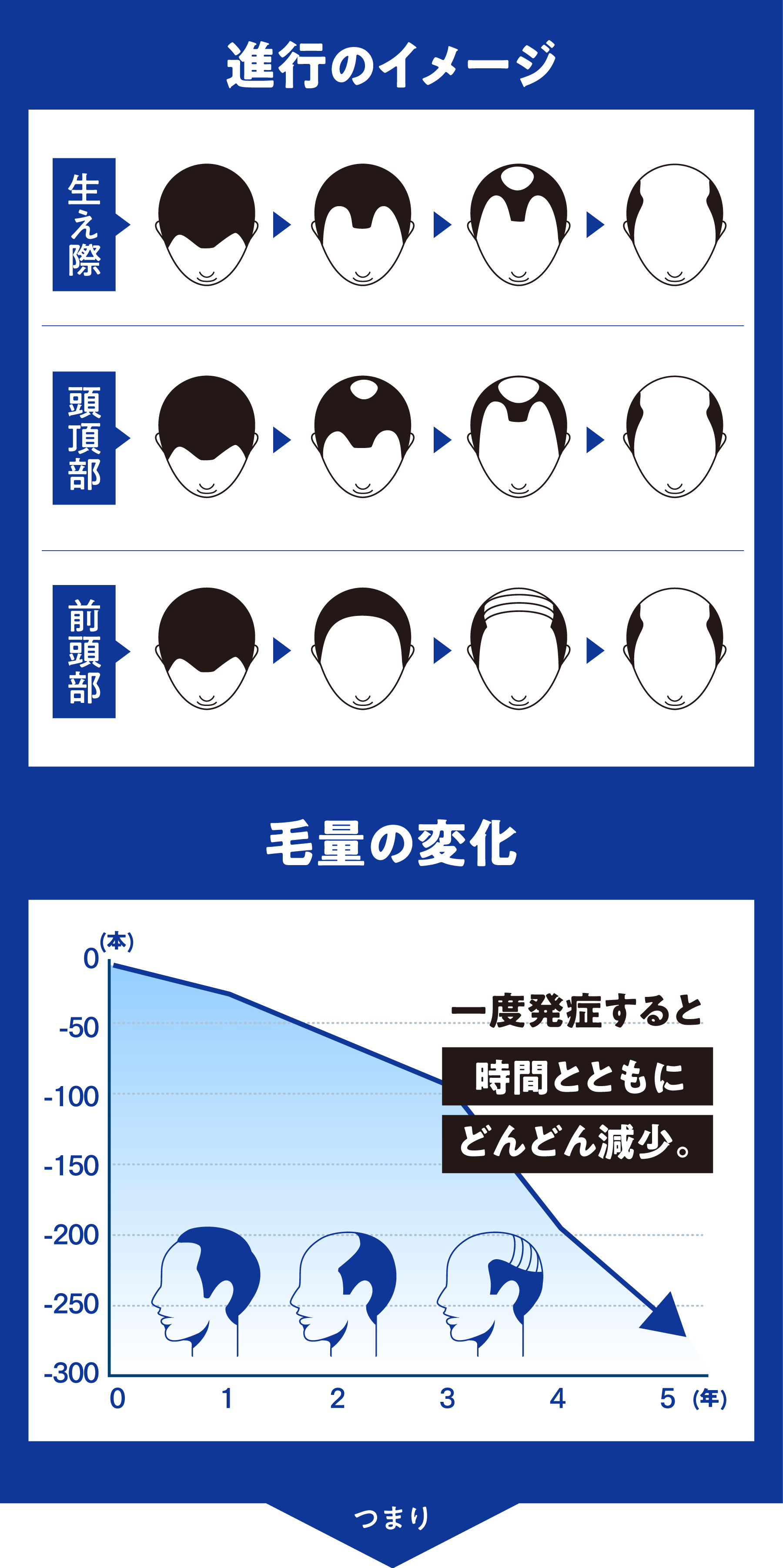 進行のイメージ・毛量の変化